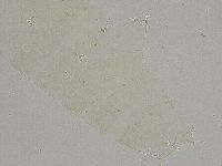 Ramazzottius oberhaeuseri image