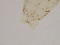 Ramazzottius oberhaeuseri image