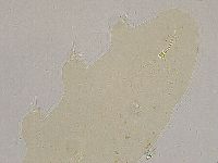 Ramazzottius oberhaeuseri image