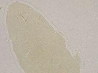 Ramazzottius oberhaeuseri image
