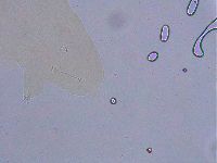 Ramazzottius oberhaeuseri image
