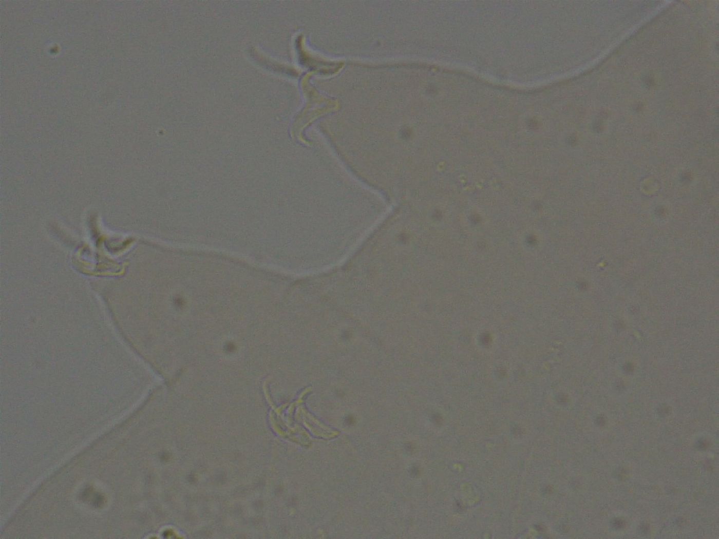 Ramazzottius oberhaeuseri image