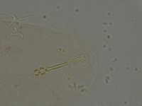 Ramazzottius oberhaeuseri image