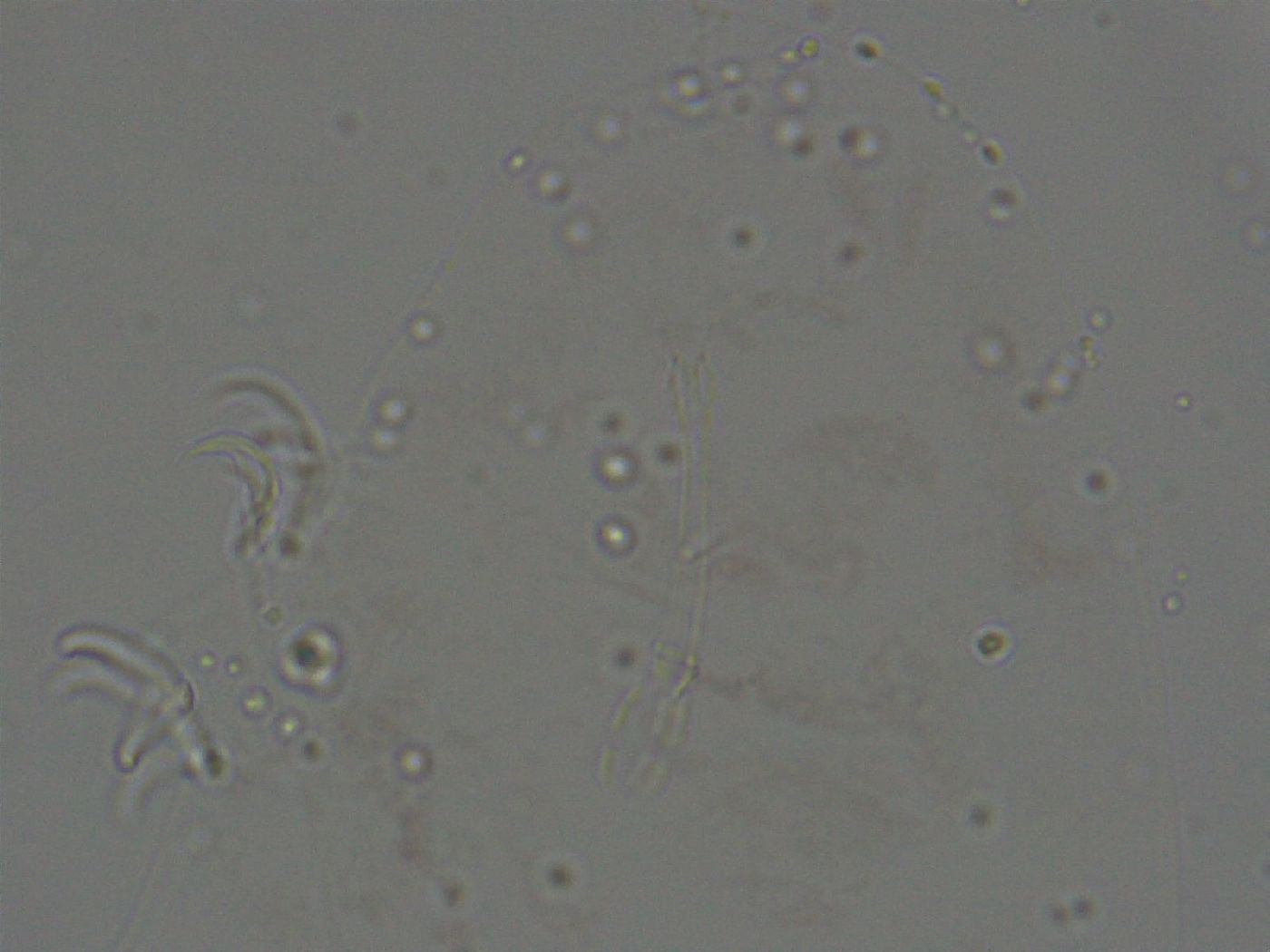 Ramazzottius oberhaeuseri image