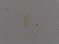 Ramazzottius oberhaeuseri image