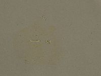 Ramazzottius oberhaeuseri image