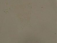 Ramazzottius oberhaeuseri image