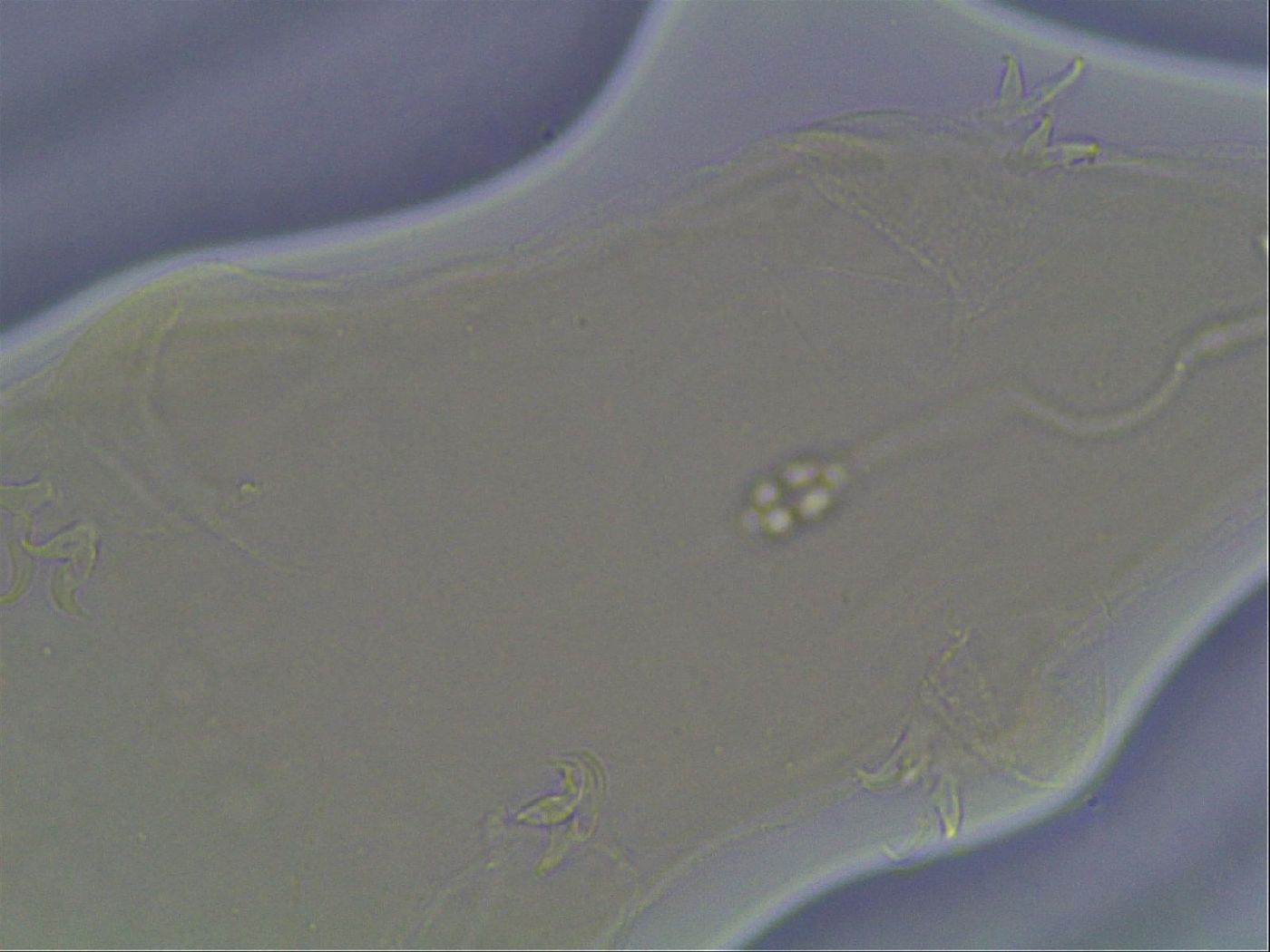 Pilatobius oculatus image