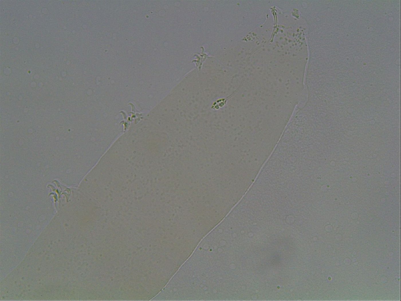 Pilatobius oculatus image