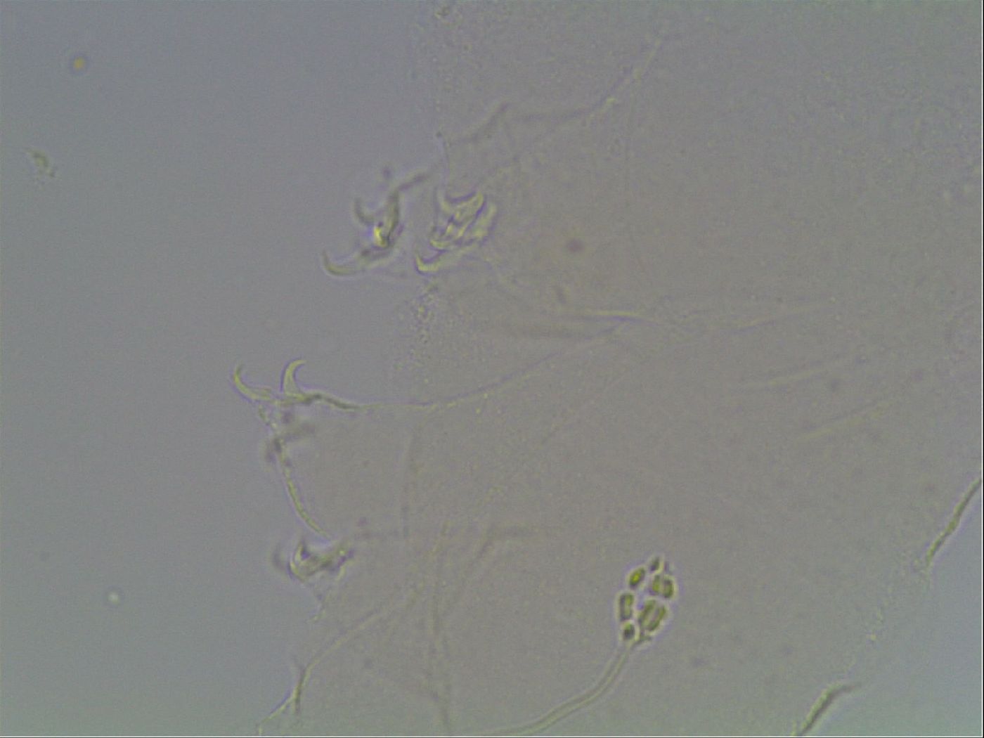 Pilatobius oculatus image
