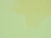 Pilatobius oculatus image