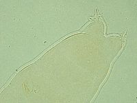 Pilatobius oculatus image