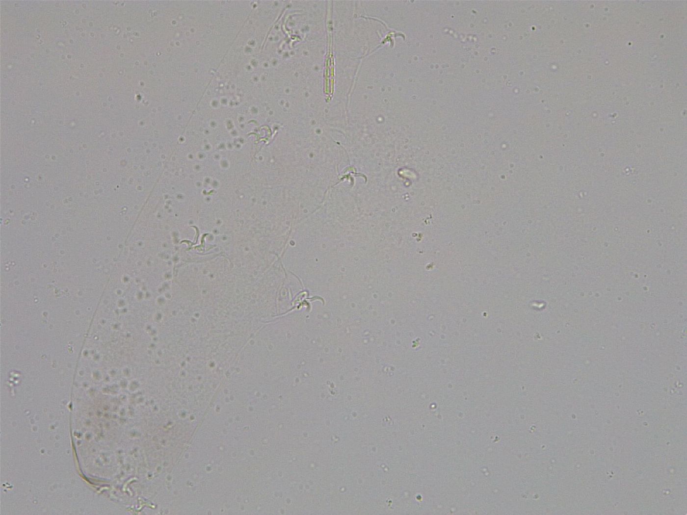 Diphascon higginsi image