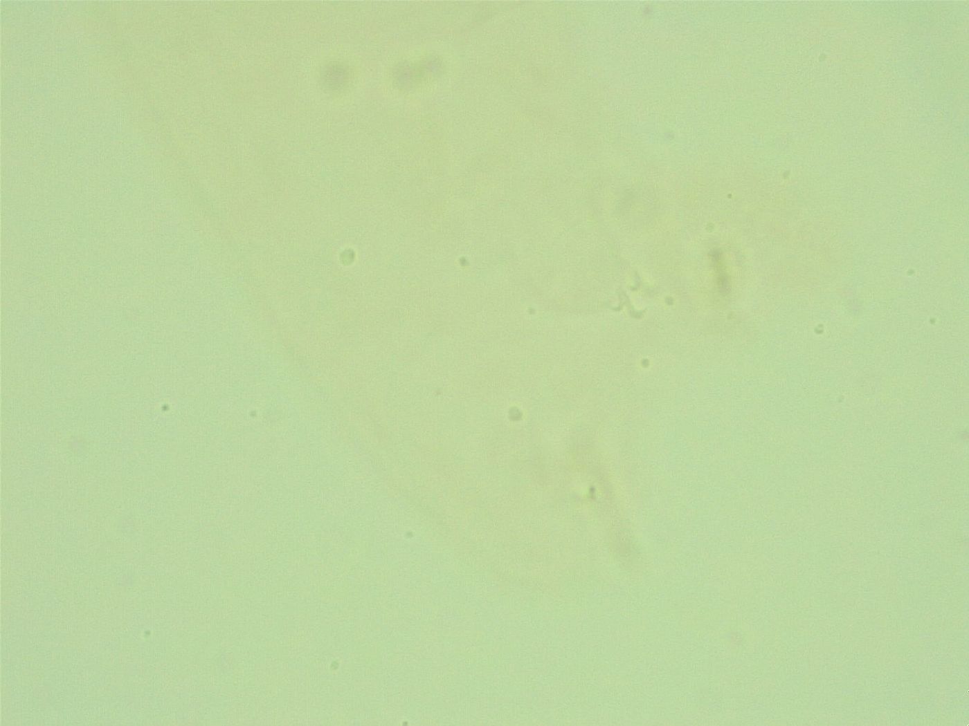 Diphascon alpinum image