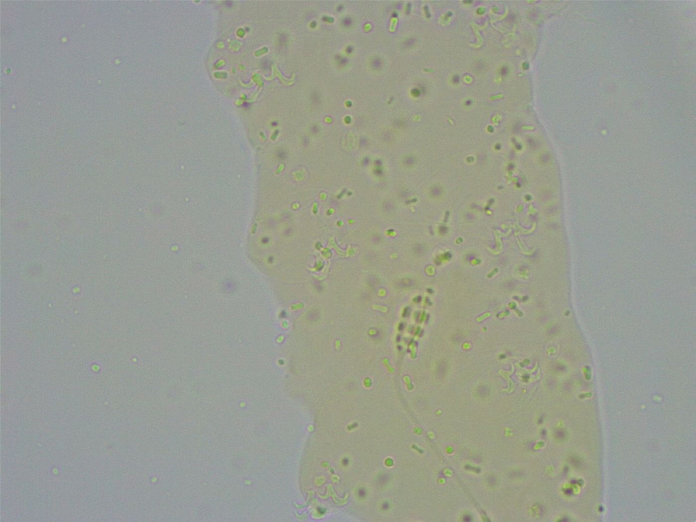 Diphasconinae image
