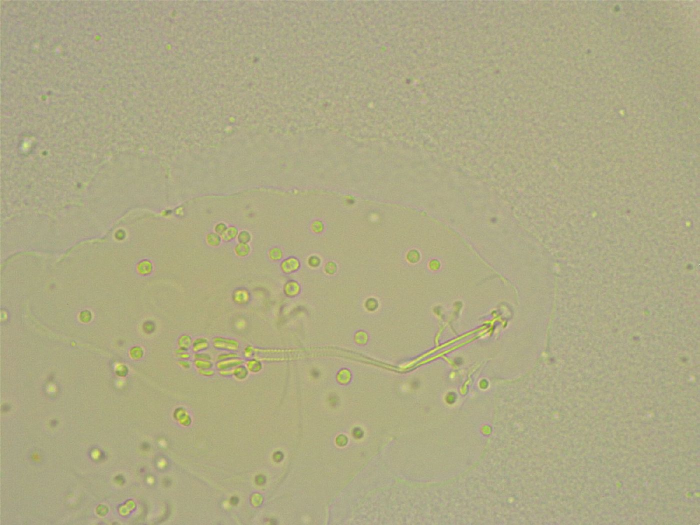 Pilatobius bullatus image