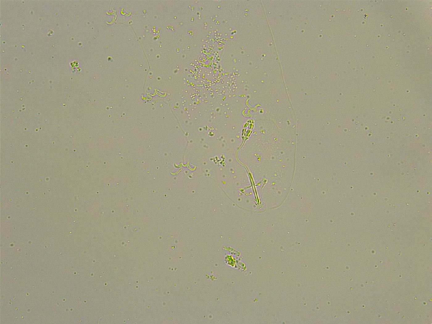Pilatobius bullatus image