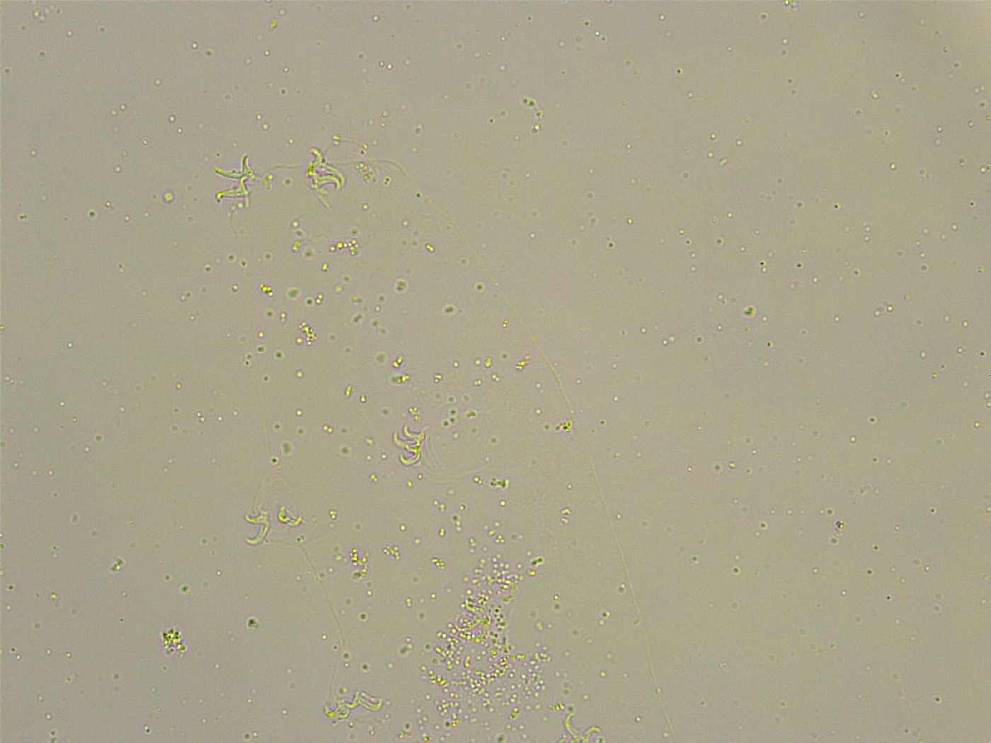 Pilatobius bullatus image