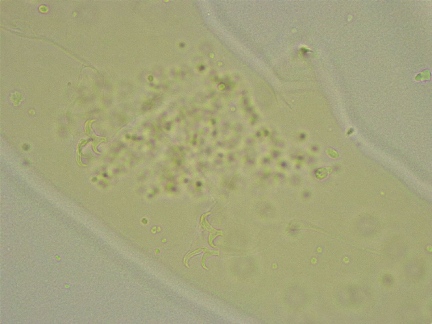 Diphascon chilenense image