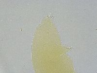 Ramazzottius oberhaeuseri image