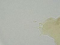 Ramazzottius oberhaeuseri image