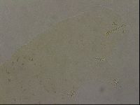 Ramazzottius oberhaeuseri image