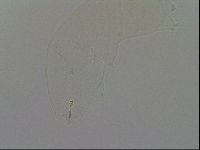 Ramazzottius oberhaeuseri image