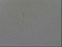 Ramazzottius oberhaeuseri image