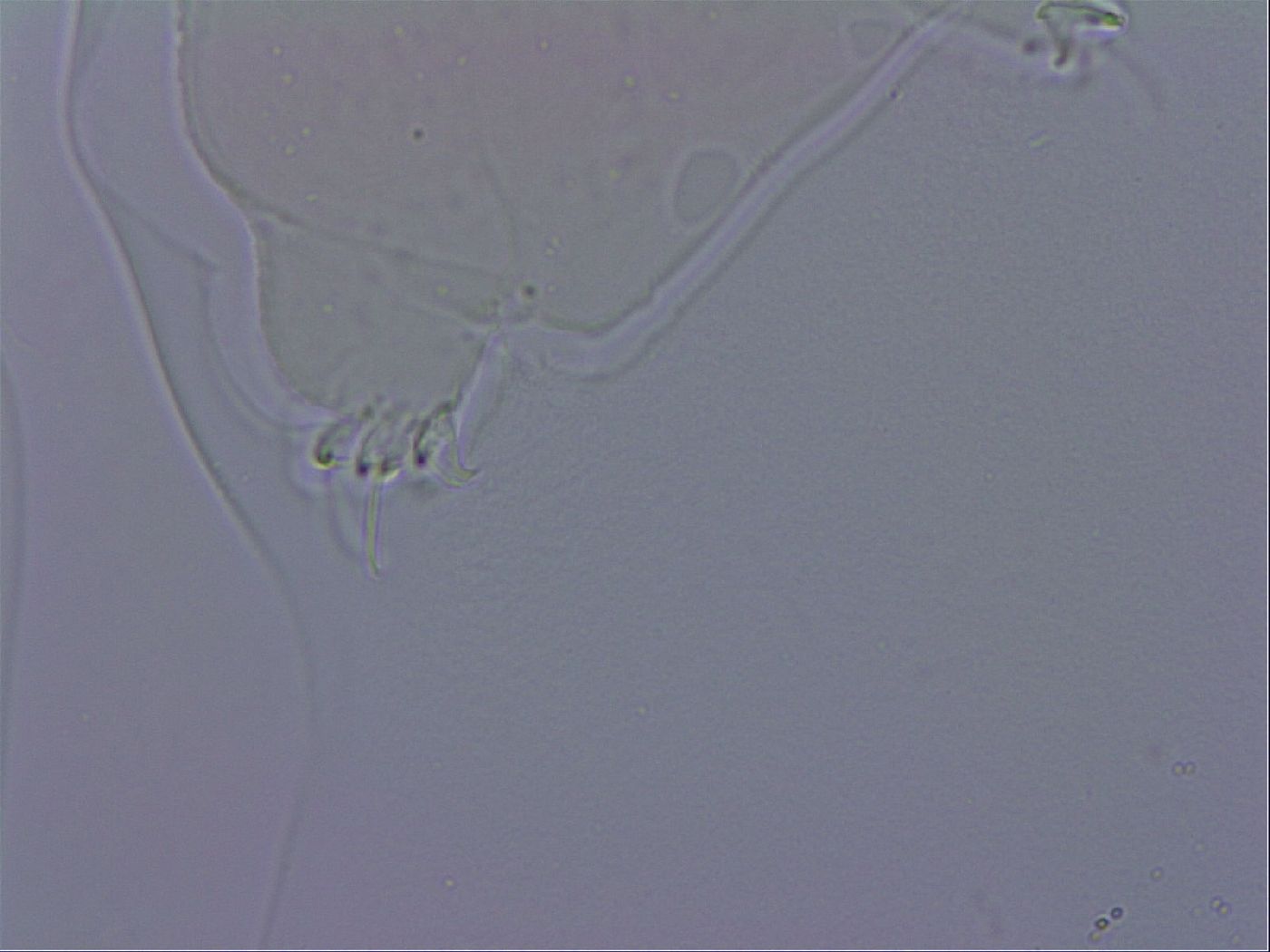 Ramazzottius oberhaeuseri image