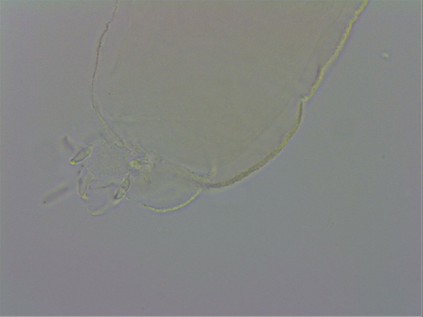 Pilatobius oculatus alpinus image