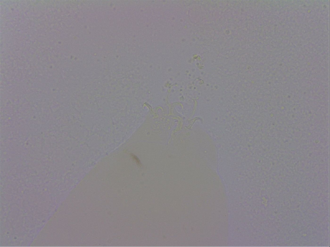 Isohypsibius prosostomus image