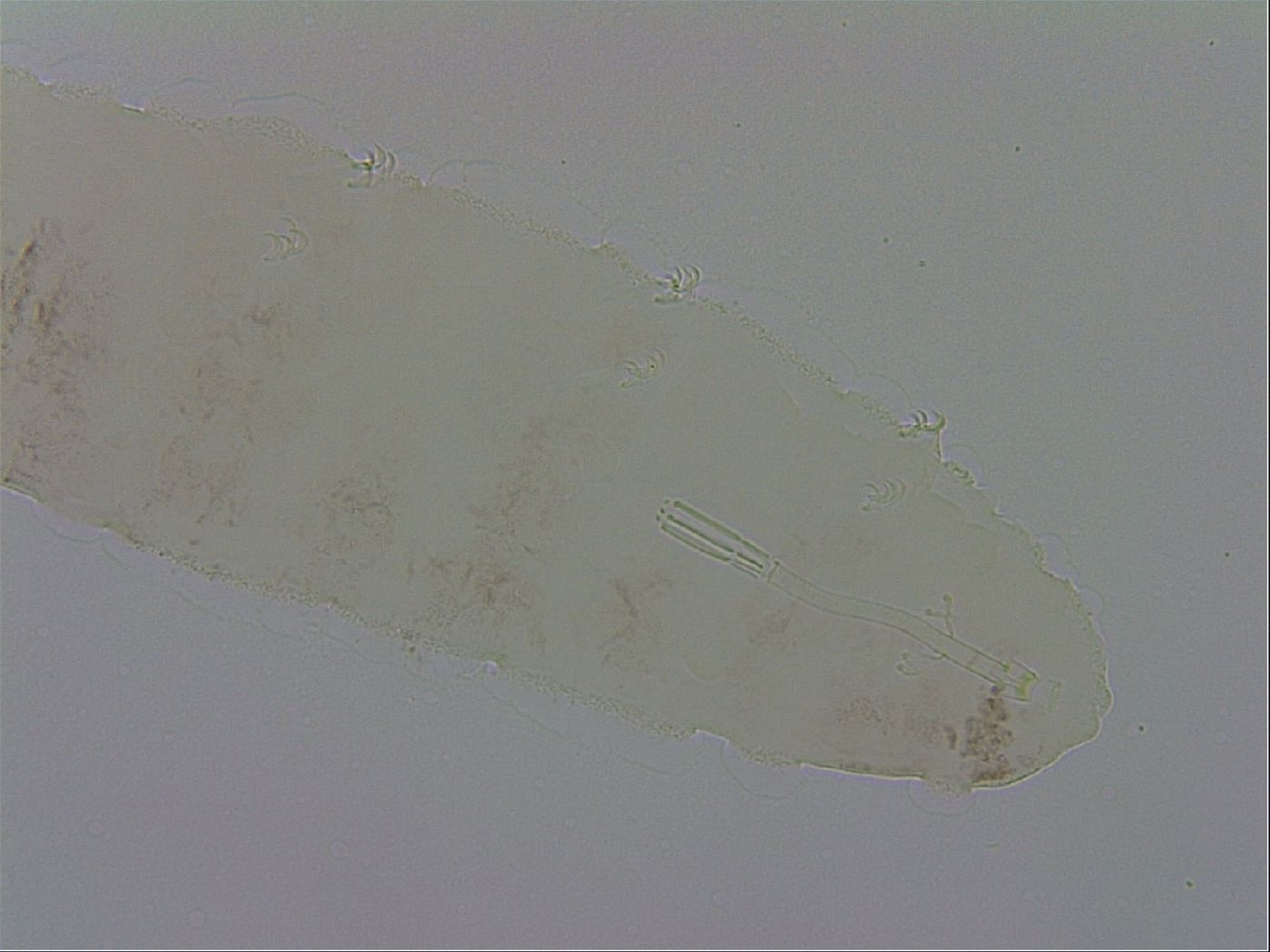 Mesocrista image