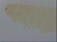 Mesocrista spitzbergensis image