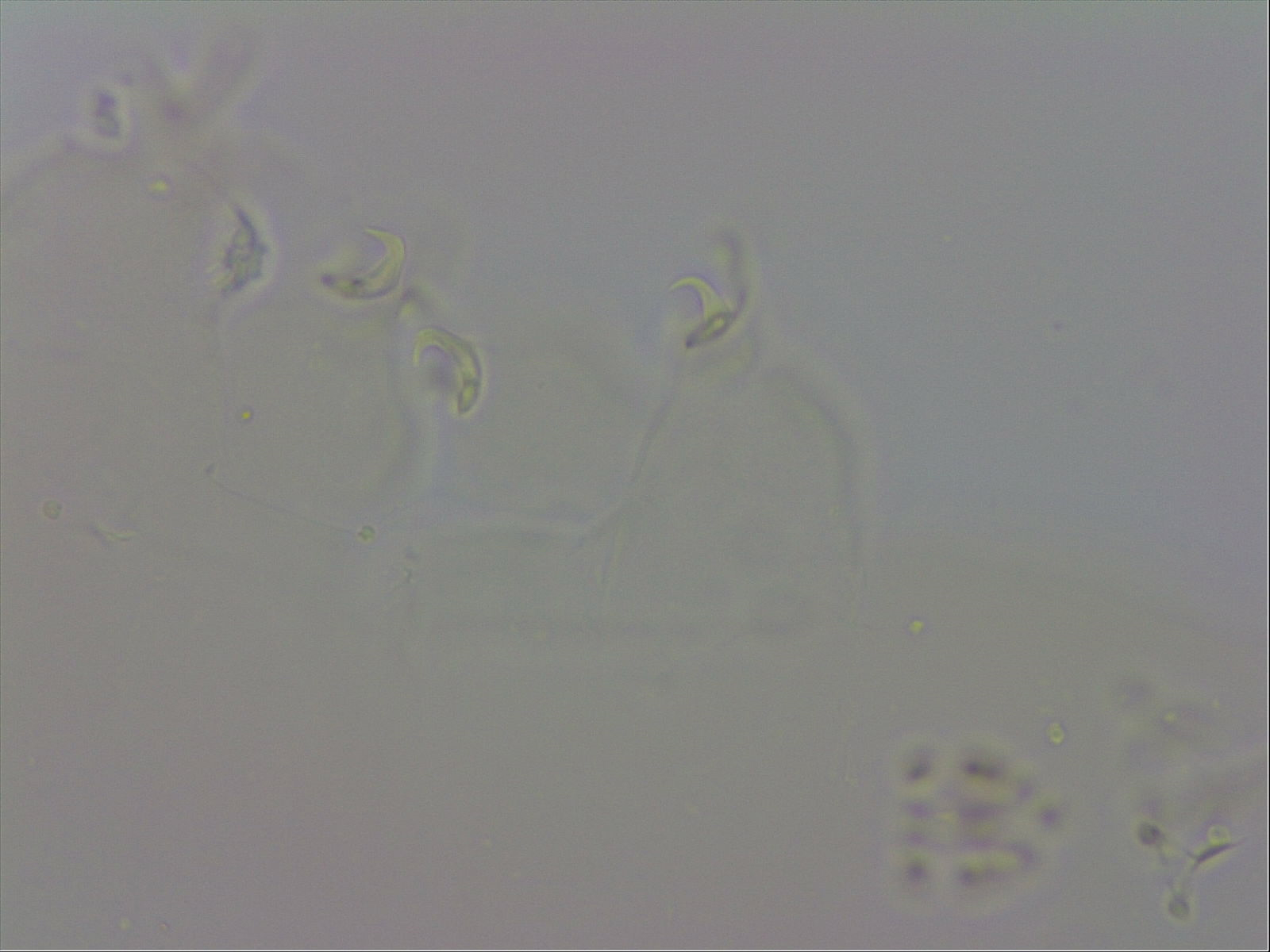 Doryphoribius evelinae image