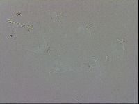 Doryphoribius evelinae image