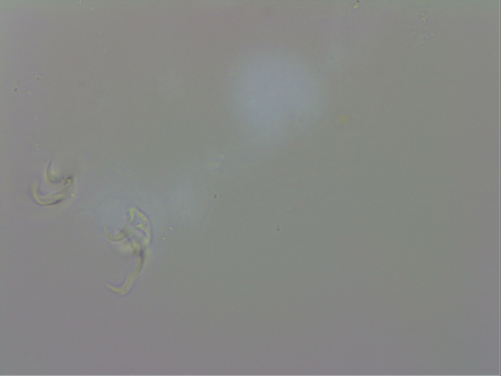 Doryphoribius evelinae image