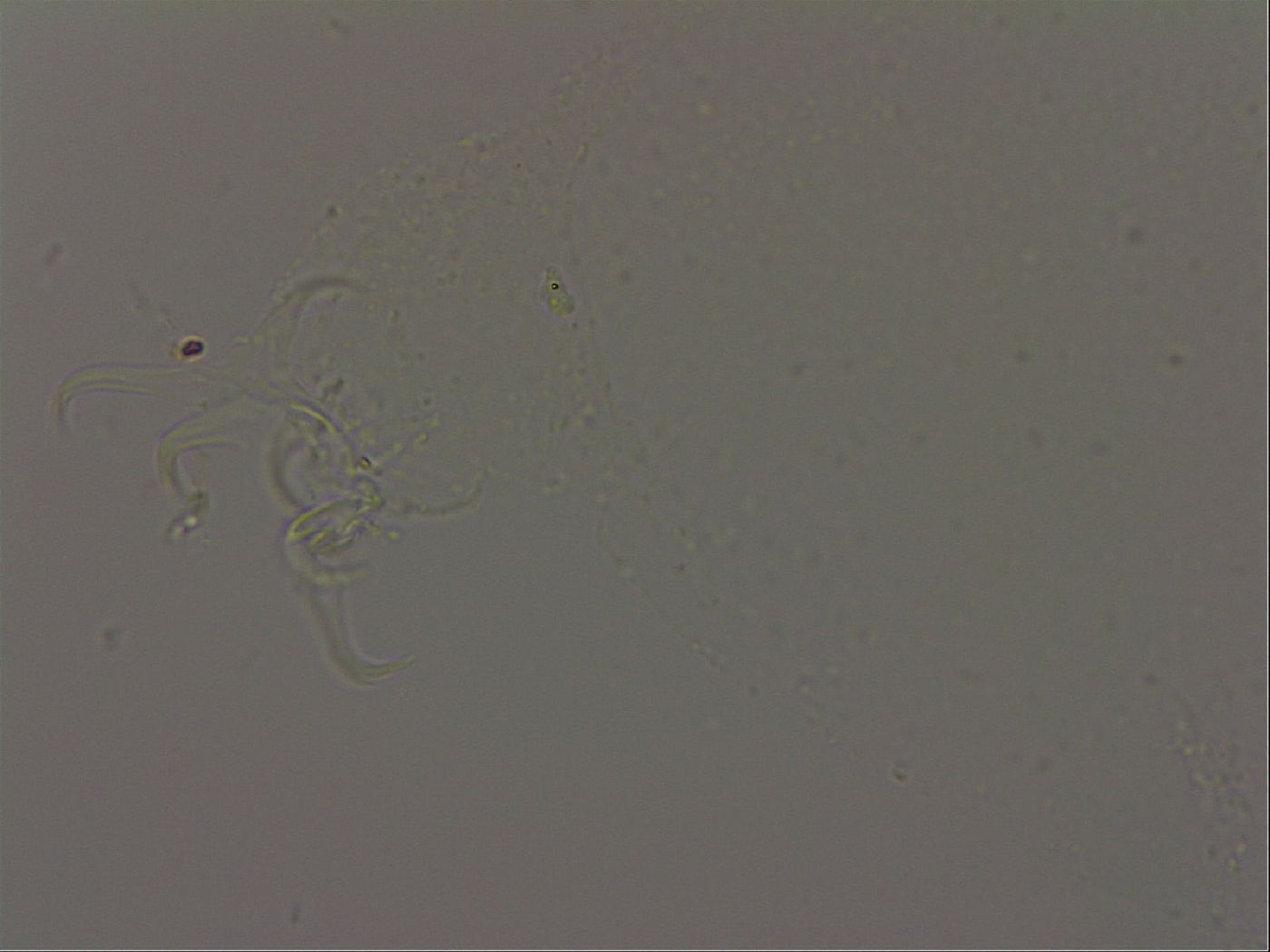 Isohypsibius granulifer image