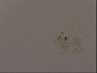 Isohypsibius granulifer image