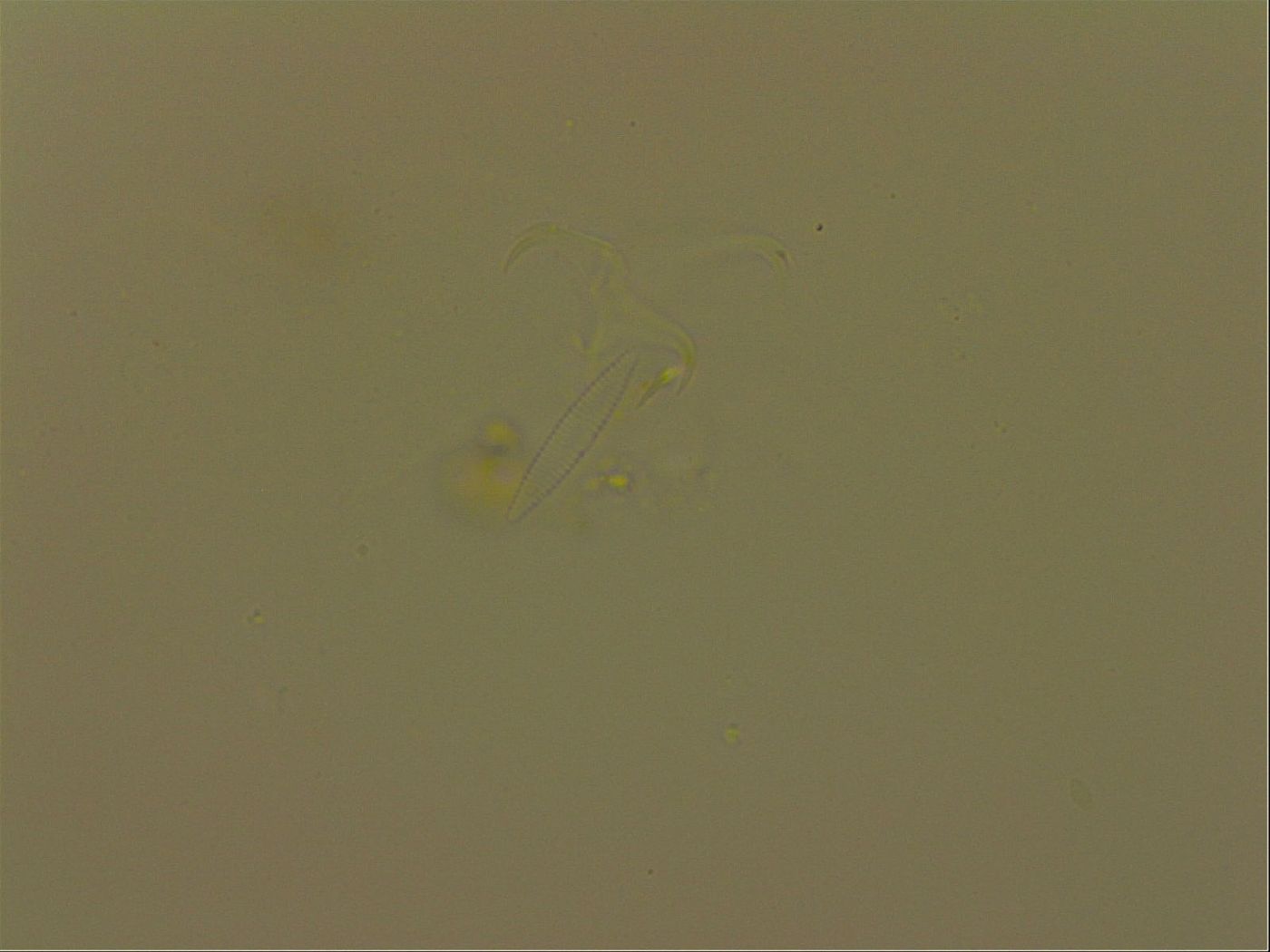 Isohypsibius granulifer image