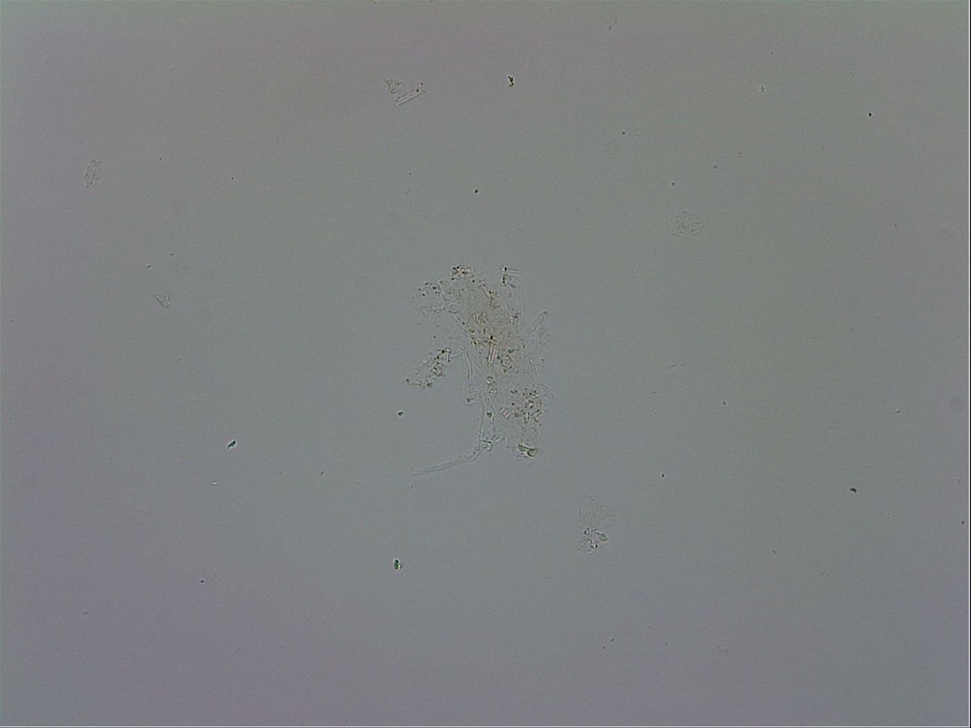 Isohypsibius granulifer image