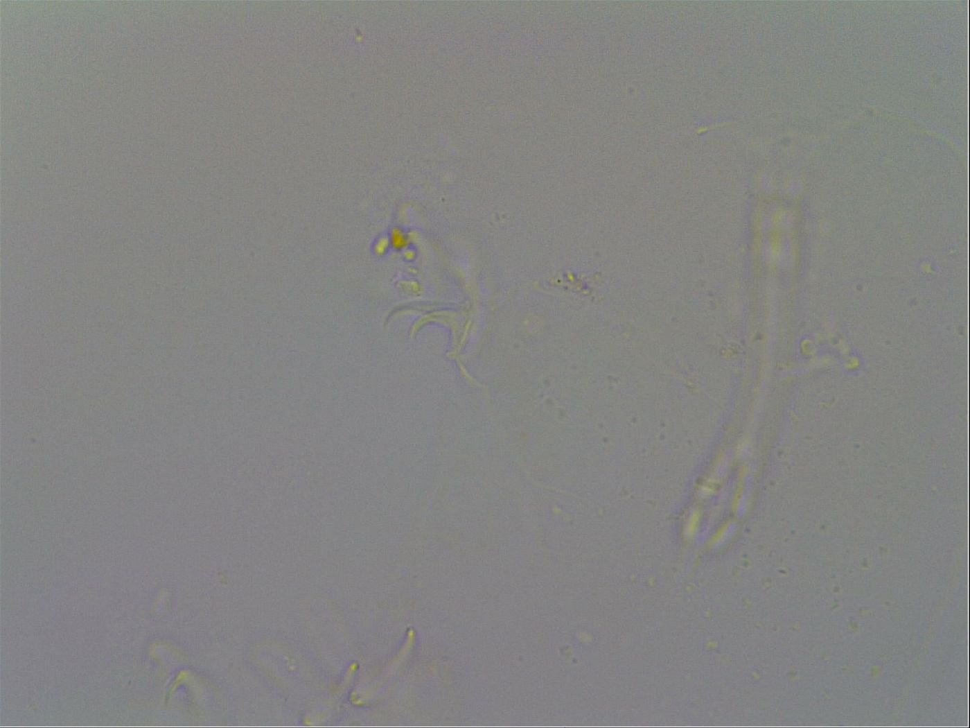 Isohypsibius granulifer image