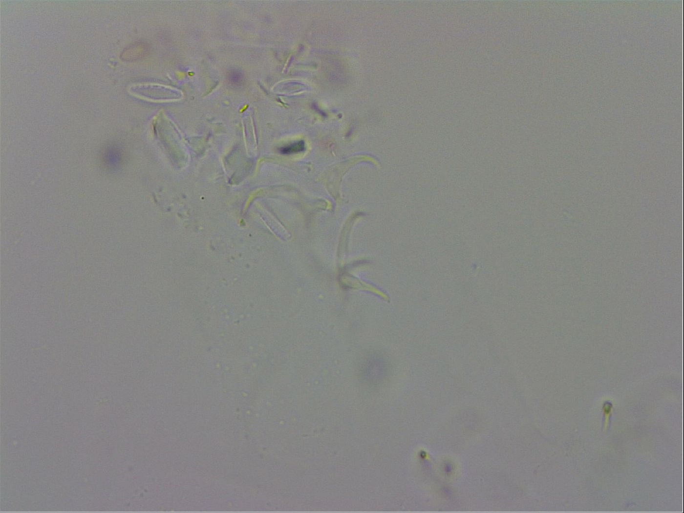 Isohypsibius granulifer image