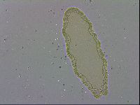 Isohypsibius lunulatus image