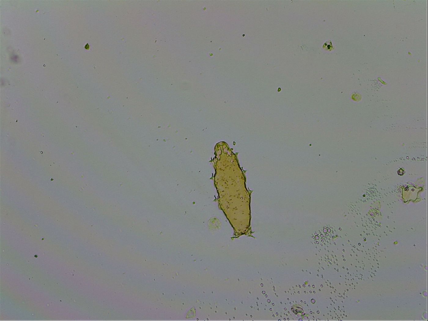 Isohypsibius macrodactylus image