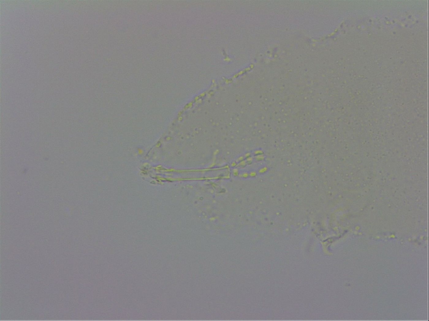 Isohypsibius prosostomus image