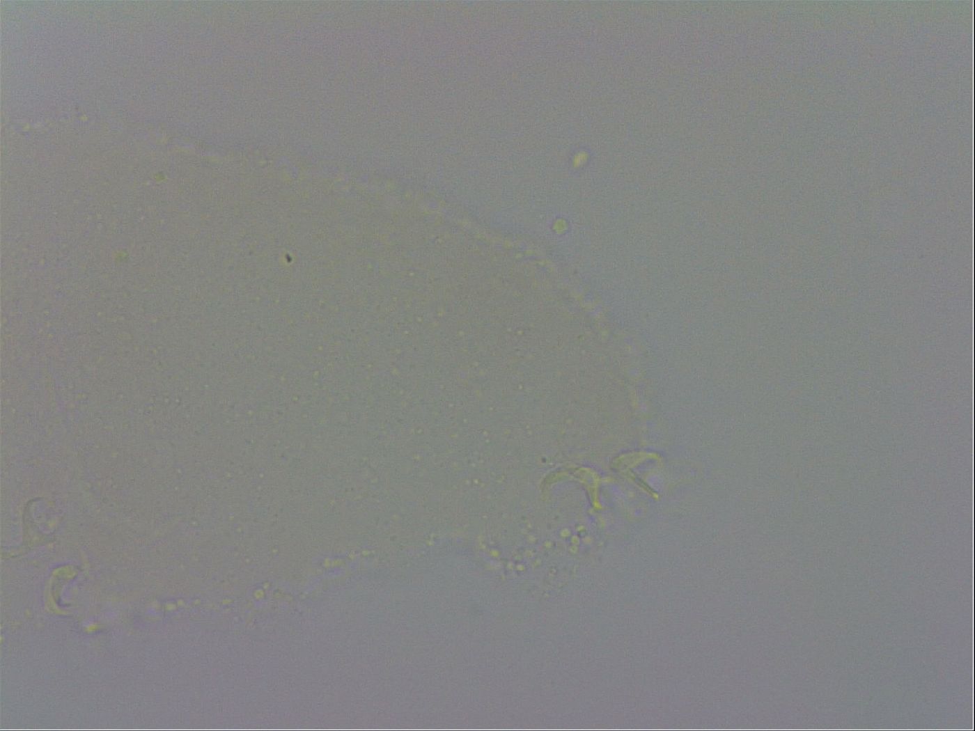 Isohypsibius prosostomus image