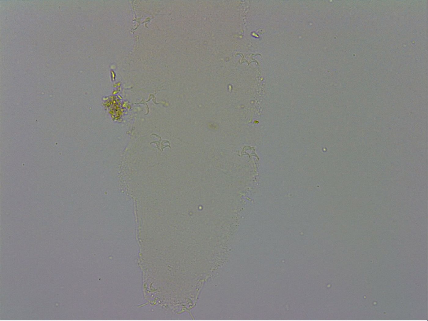 Isohypsibius prosostomus image