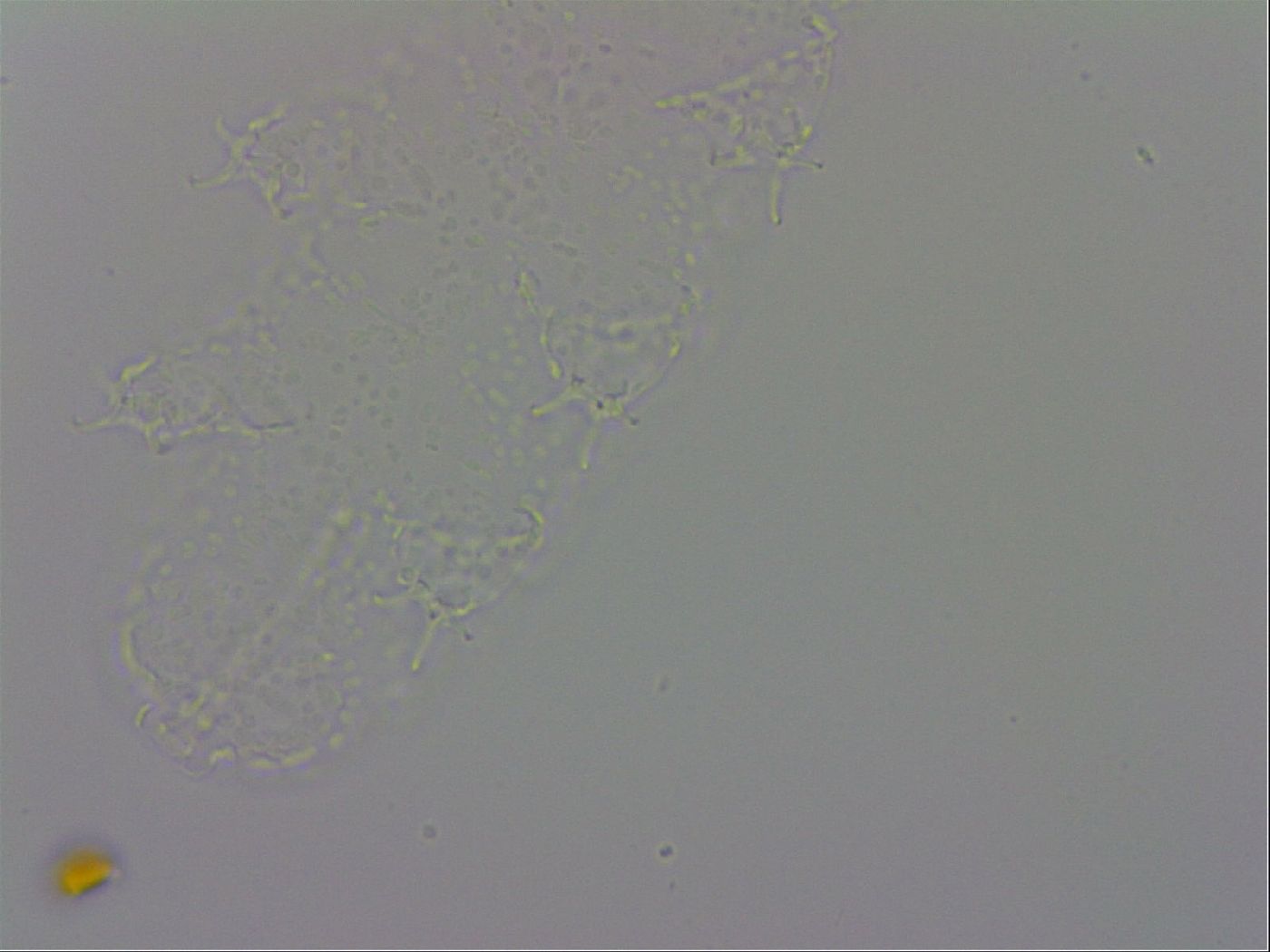 Isohypsibius prosostomus image