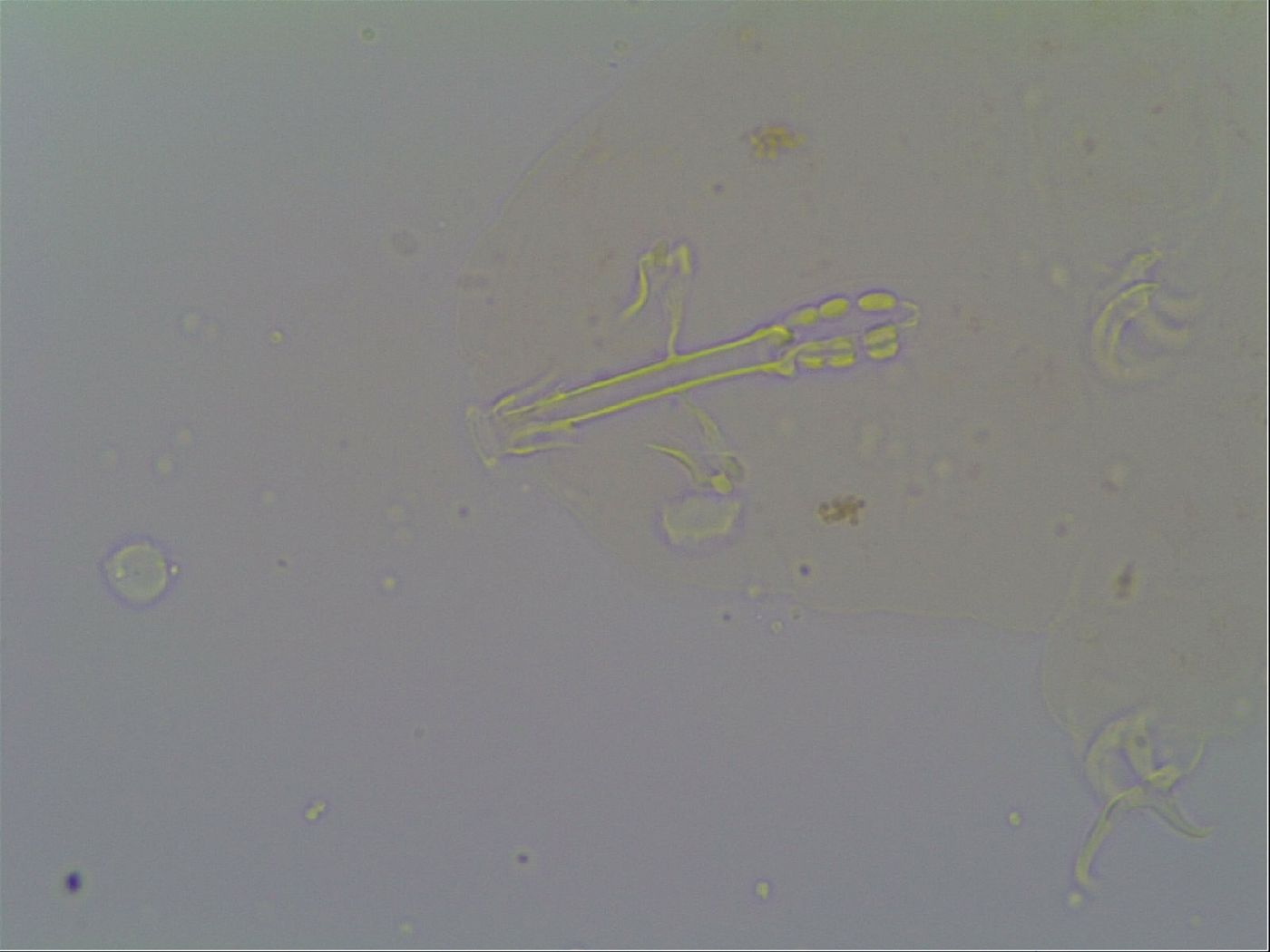 Isohypsibius prosostomus image