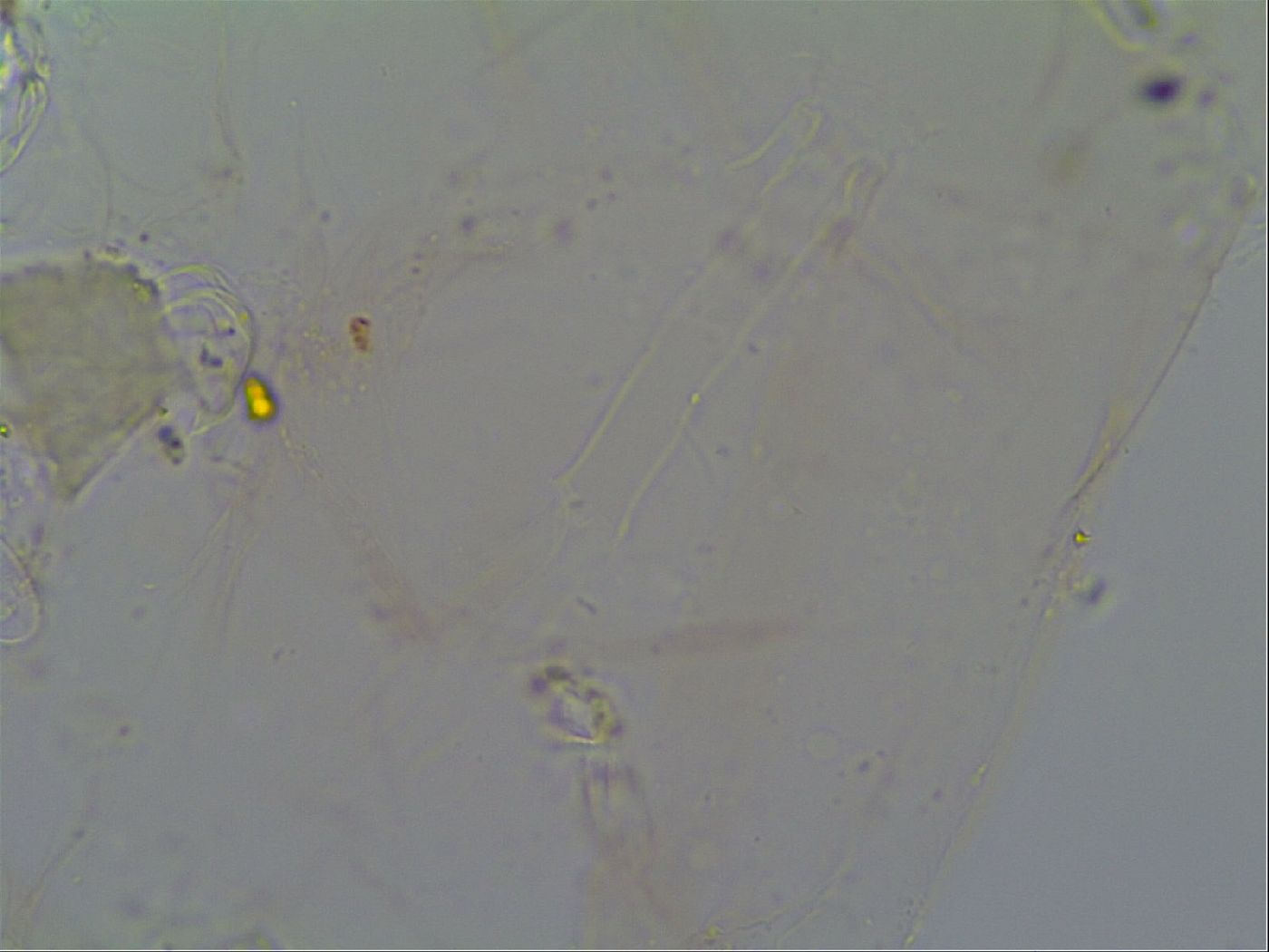 Thulinius saltursus image